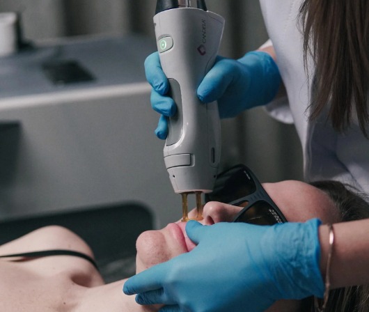 Candela GentleMax Pro Plus